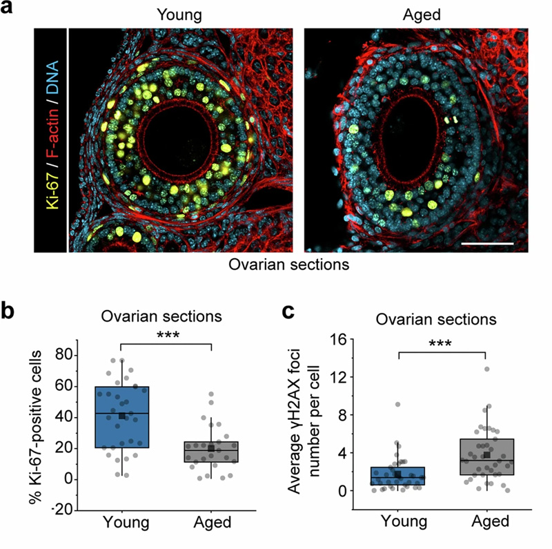 卵泡積累與年齡相關(guān)的異常