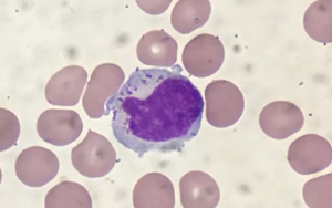 PNAS首次表明：人體組織中駐留在肺部的NK細胞在代謝方面與血液中循環(huán)的NK細胞不同