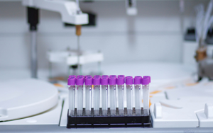 轉(zhuǎn)染試劑小白入門(mén)指南