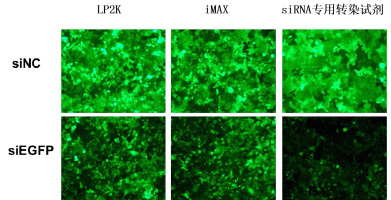 穩(wěn)定表達(dá)GFP的HeLa-EGFP細(xì)胞，沉默siEGFP，48h后熒光拍照