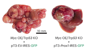 《Nature Genetics》PROX1積極抑制細(xì)胞命運(yùn)可塑性，保護(hù)肝細(xì)胞身份，防止肝腫瘤發(fā)生
