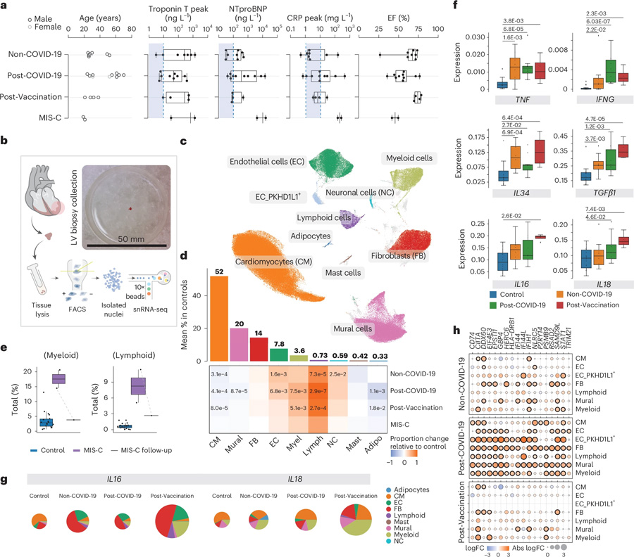 非COVID-19、COVID-19后以及疫苗接種后的炎癥性心肌病具有獨特的細胞和分子特征
