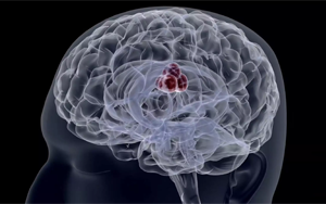 PNAS：將侵襲性癌細(xì)胞重新編程為無害的癌細(xì)胞