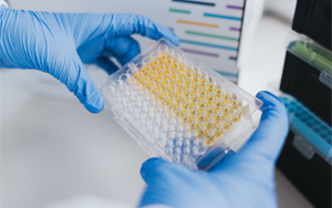 免疫技術(shù)新視界：層析、印跡、吸附與比濁的前沿碰撞