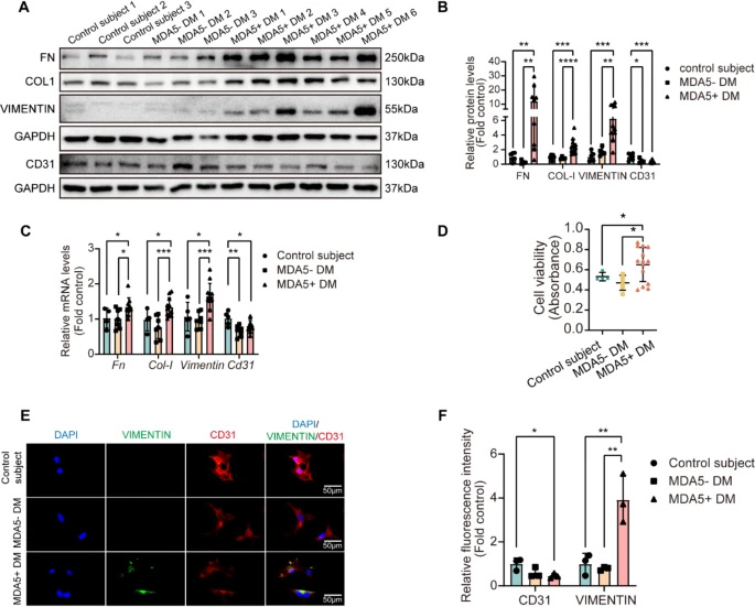 MDA5陽性皮肌炎患者血清可誘導原代小鼠肺微血管內(nèi)皮細胞發(fā)生內(nèi)皮-間質(zhì)轉(zhuǎn)化