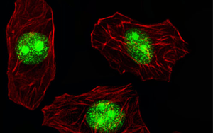 細(xì)胞表面的RNA結(jié)合蛋白是對(duì)抗癌癥的關(guān)鍵