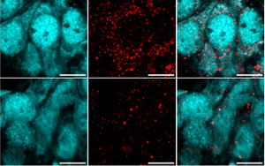 重大發(fā)現(xiàn)！阿爾茨海默病患者來源的高分子量 tau 蛋白如何 “破壞” 海馬神經(jīng)元？