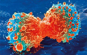 Nature Genetics：腫瘤轉(zhuǎn)移過程中會(huì)積累更多的拷貝數(shù)變異，而不是突變