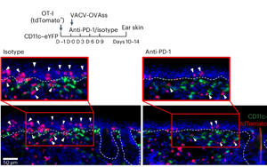 PD-1通過TGFβ信號通路調(diào)控皮膚組織駐留記憶T細(xì)胞（TRM）形成與功能分化的機(jī)制研究