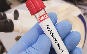 副流感病毒（HPIV1、2、3型）抗原檢測(cè)-免疫層析 （膠體金、彩色乳膠及熒光免疫層析）解決方案