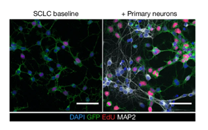 神經(jīng)元活動依賴性機制驅(qū)動小細(xì)胞肺癌發(fā)病機制的新見解