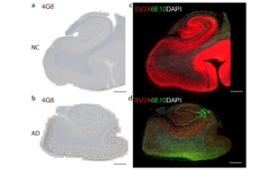 阿爾茨海默病中突觸囊泡蛋白2A在腦組織及胞外囊泡中的減少及其與Aβ、tau和APOEε4的關(guān)聯(lián)研究