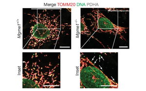 核糖核苷酸滲入線粒體DNA驅(qū)動炎癥反應(yīng)——揭示核苷酸代謝失衡引發(fā)年齡相關(guān)性炎癥的新機(jī)制