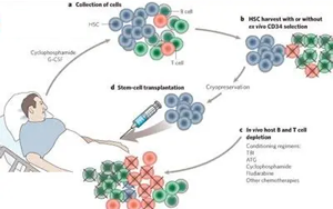 自體造血干細(xì)胞移植時S期殘留克隆性漿細(xì)胞對多發(fā)性骨髓瘤臨床預(yù)后的影響研究