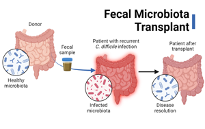 Nature Microbiology：新方法可追蹤腸菌移植后的微生物菌株