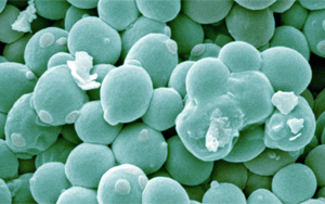 工程化產(chǎn)丁酸酵母通過協(xié)同作用改善阿爾茨海默病相關(guān)表型