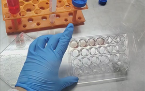 精準營養(yǎng)，塑造未來：類器官培養(yǎng)基的新紀元