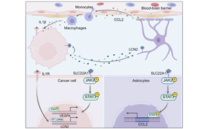 脂質(zhì)運載蛋白-2通過腫瘤-微環(huán)境互作驅(qū)動肺癌腦轉(zhuǎn)移進展