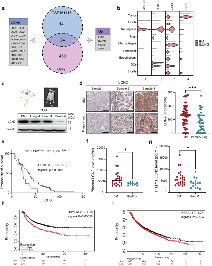 LCN2在腦轉(zhuǎn)移組織中過(guò)表達(dá)，且與肺癌患者的不良預(yù)后相關(guān)