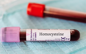 同型半胱氨酸（HCY）-磁微?；瘜W發(fā)光法（AE/AP） +熒光免疫層析解決方案