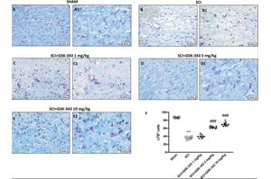 GSK-343通過抑制EZH2減輕小鼠脊髓損傷后的神經炎癥：靶向TRAF6/NF-κB通路的新表觀遺傳策略
