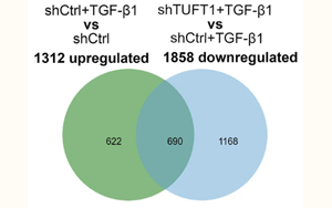 TUFT1通過穩(wěn)定TβRII蛋白促進肝星狀細胞活化為促轉移肌成纖維細胞的新機制及其在結直腸癌肝轉移中的作用