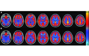 AJCN：要長(zhǎng)壽，常吃豆！長(zhǎng)期食用大豆飲食可讓大腦“更靈光”