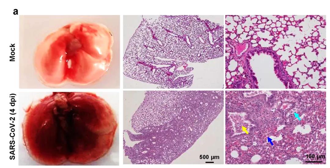 ?建模成功！Nature子刊：成功建立新冠肺炎重癥模型，揭示新冠病毒感染的分子機制