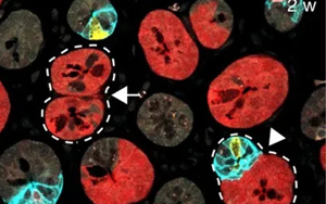Nature 三連重磅！識破癌細(xì)胞的“詭計(jì)”，為結(jié)直腸癌患者帶來新希望