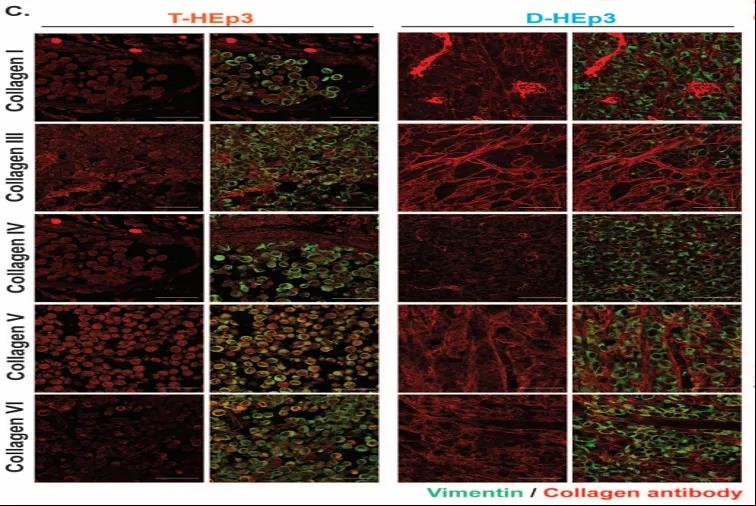 讓癌細(xì)胞“一睡不醒”！向腫瘤微環(huán)境中添加III型膠原蛋白可防止腫瘤復(fù)發(fā)和轉(zhuǎn)移