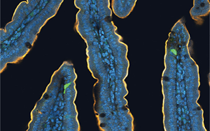 喝完無糖飲料還想吃甜食？人們對(duì)糖的渴望，無法被甜味劑替代，答案都在腸道里！