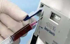 血氣分析技術(shù)介紹及產(chǎn)品一覽