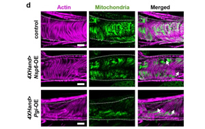SARS-CoV-2病毒蛋白如何損害心臟的