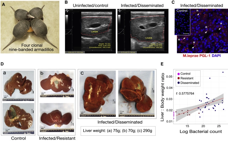 麻風(fēng)分枝桿菌促進(jìn)成年九帶犰狳體內(nèi)正常肝臟器官生長而無肝損傷