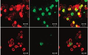 Nature Aging：觸發(fā)大腦的免疫細(xì)胞可以減緩阿爾茨海默病