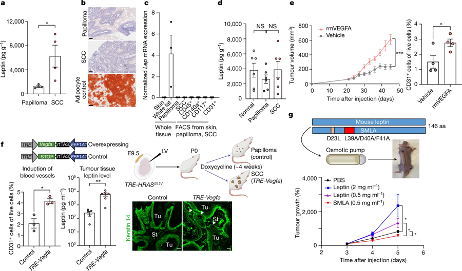 惡性腫瘤微環(huán)境中瘦素水平升高，是由血管生成增加引起的