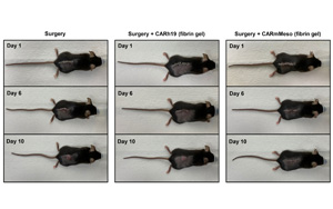 CAR-T細(xì)胞療法再獲突破！有效清除術(shù)后殘留癌細(xì)胞、預(yù)防腫瘤復(fù)發(fā)，即將開展臨床試驗(yàn)