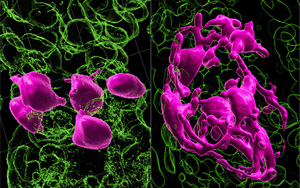 黑發(fā)原來是這樣變白的！Nature最新研究發(fā)現(xiàn)逆轉白發(fā)的關鍵所在