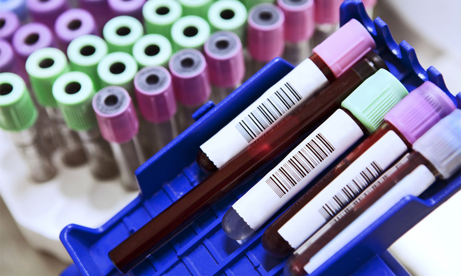 乳酸脫氫酶（LD/LDH）檢測(cè)