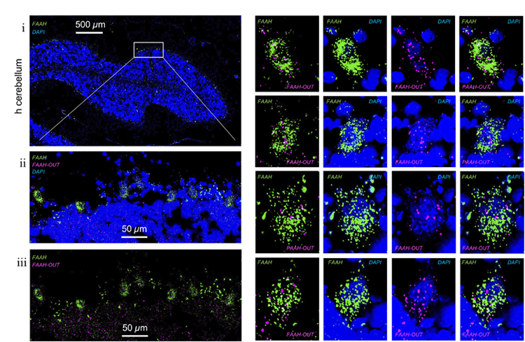 FAAH和FAAH-OUT RNA在人腦組織細(xì)胞中的表達(dá)水平和定位
