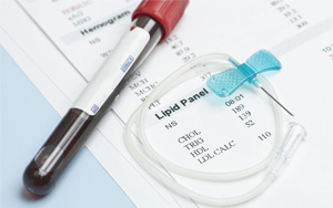 總膽固醇（TC）檢測(cè)試劑盒用原輔料