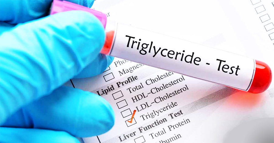 甘油三酯（TG）檢測(cè)