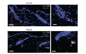 IL-17蛋白對皮膚老化的關(guān)鍵作用