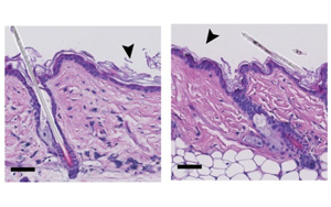 在皮膚老化中起關(guān)鍵作用的蛋白質(zhì)