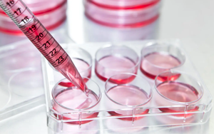 細(xì)胞培養(yǎng)的根本-細(xì)胞株/細(xì)胞系