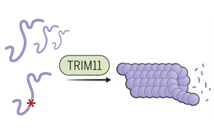 Science：第一次確定了監(jiān)督tau功能的基因
