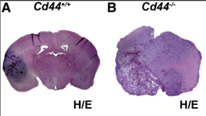 肺癌腦轉(zhuǎn)移的新機(jī)制