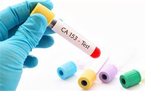 糖類抗原15-3(CA15-3)-磁微粒化學(xué)發(fā)光法（AE/AP）解決方案