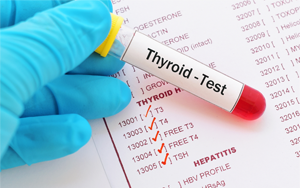 促甲狀腺素（TSH）-磁微粒化學(xué)發(fā)光法（吖啶酯） /熒光免疫層析解決方案
