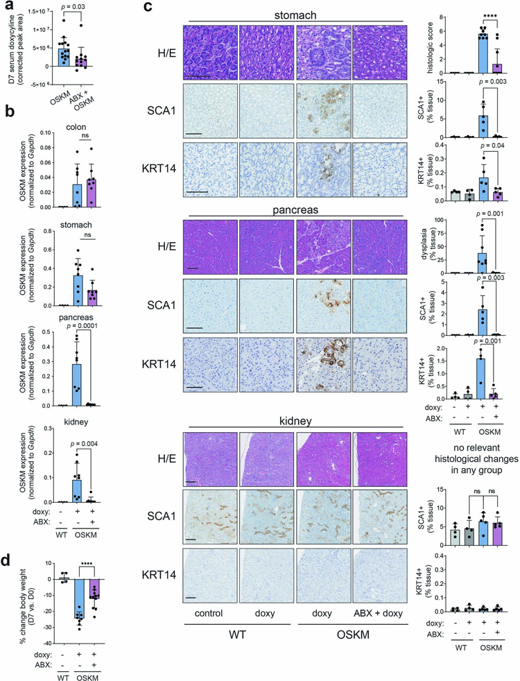 廣譜抗生素治療抑制體內(nèi)重編程
